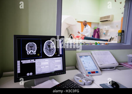 Digital brain scan on computer monitor Stock Photo