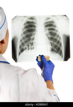 Doctor is looking X-ray of the chest Stock Photo