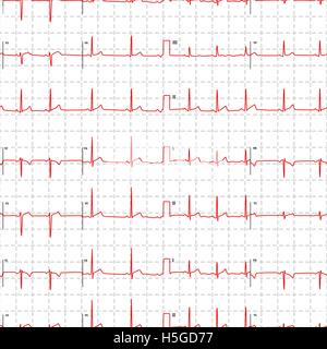 Electrocardiogram red graph with marks on white, seamless pattern Stock Vector