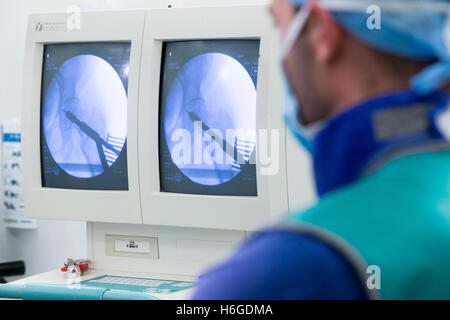 Technician in the theatre checking X Ray of a left decompression hip screw operation more commonly known as a hip replacement Stock Photo