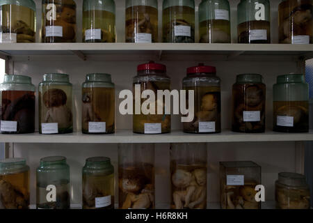 Jars of foetuses with defects from exposure to Agent Orange Dioxin used in the Vietnam War, Tu Do Hospital Ho Chi Minh city Stock Photo