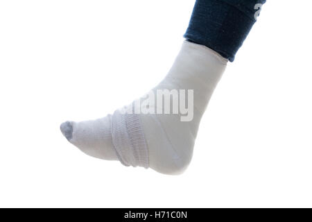 Leg cast covered with a sock to warm up the toes and keep them from getting cold.  (isolated on white) Stock Photo