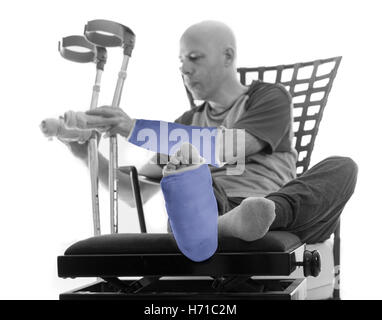 Young man after a bad accident with broken ankle and wrist and plaster and fiberglass casts on his leg and arm, putting down his Stock Photo
