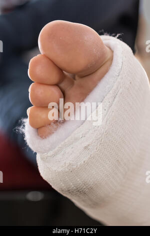 Close up of a fiberglass / plaster leg cast and toes Stock Photo