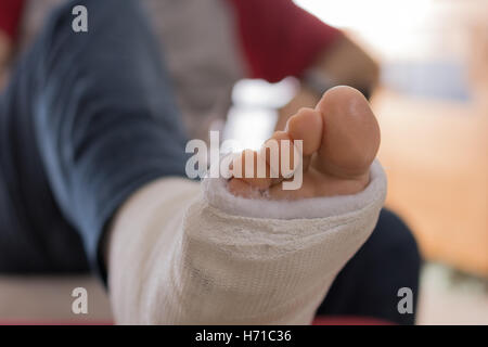 Young man with a broken ankle and a white cast on his leg, sitting on a couch (bokeh) Stock Photo