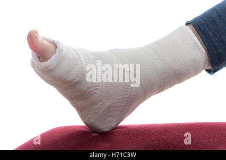 Close up of a fiberglass / Plaster leg cast and toes Stock Photo