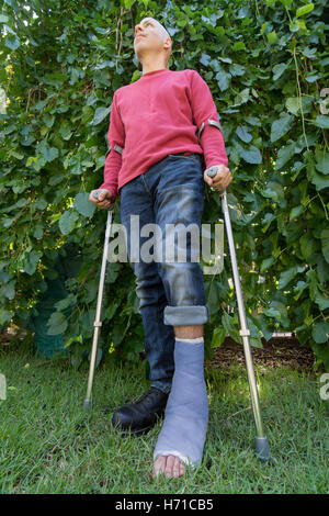 Young man with a broken ankle and a blue fiberglass and plaster cast on his leg, getting some fresh air in the garden while walk Stock Photo