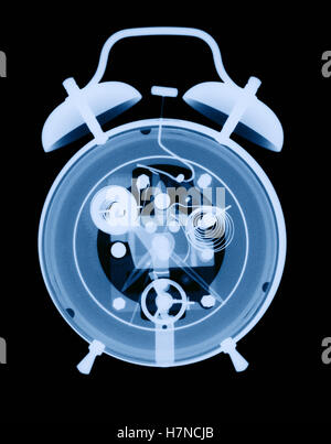 X-ray of alarm clock Stock Photo