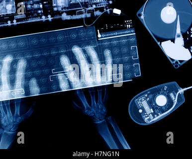 x-ray of arm and hands at computer keyboard Stock Photo