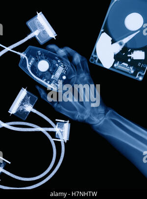 x-ray of arm holding computer mouse Stock Photo