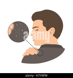 Dandruff issue on man s shoulder. Close up view. Vector illustration. Stock Vector