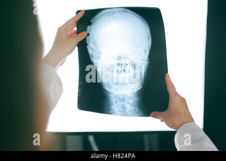 Female doctor looking at x-ray film of human head, woman in medical hospital interior examining xray screening image of skull Stock Photo