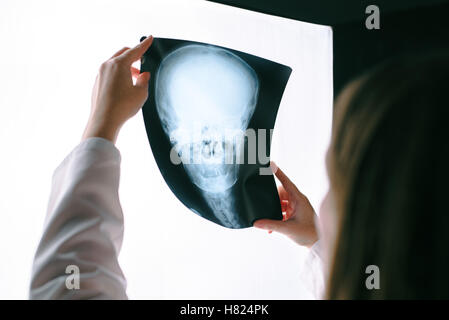 Female doctor looking at x-ray film of human head, woman in medical hospital interior examining xray screening image of skull Stock Photo