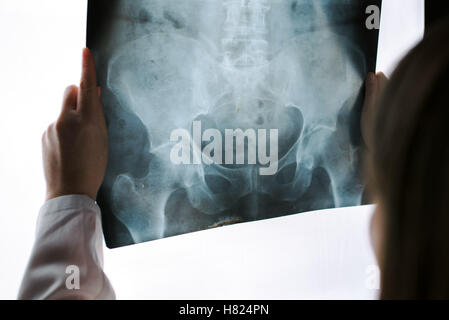 Female doctor examining pelvis x-ray in hospital office, medical professional in white uniform analyzing hip image in clinic. Stock Photo