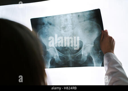 Female doctor examining pelvis x-ray in hospital office, medical professional in white uniform analyzing hip image in clinic. Stock Photo