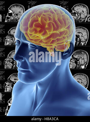 Cross section of the brain with magnetic resonance imaging. MRI / CT ...