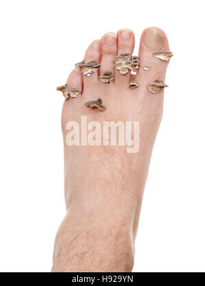 dirty infected foot mycosis on white background Stock Photo