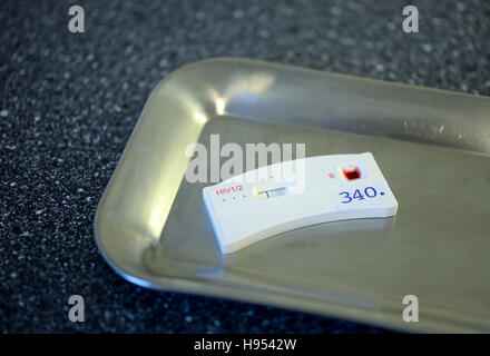 A test strip of an HIV quick test can be seen coloured after application of the blood of a young man at Berlin Aids-Hilfe (BAH) in Berlin, Germany, 15 November 2016. The result can be read between 5 and 30 minutes depending on the manufacturer. Approximately 25 quick tests are carried out daily at the Berliner Aids-Hilfe (AIDS assistance centre) in Berlin. Since 1985, the organization has provided information, support, information, counseling and testing in the of HIV and other sexually transmitted infections. Photo: BRITTA PEDERSEN/DPA Stock Photo