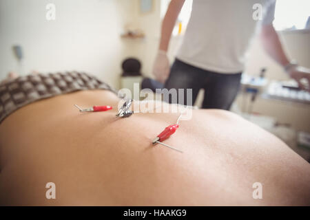 Patient getting electro dry needling on his back Stock Photo