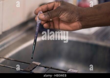 DIOILA - MALI:  A doctor works in the lab of the Intensive Nutritional Unit of the Dioila hospital on November 7 2016 in Dioila, Mali. Photo by Xaume  Stock Photo