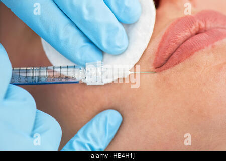 woman gets injection in her lips Stock Photo