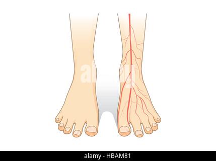 One foot showing a red blood vessel on skin. Stock Vector