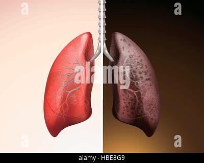 Human Anatomy of Lung Condition illustration Stock Vector Image & Art ...