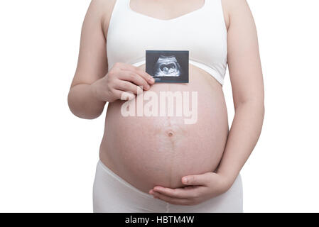 Asian pregnant woman show with ultrasound baby on white background Stock Photo