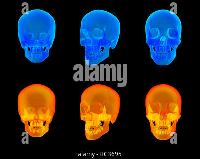 3d render of the human x ray skull Stock Photo
