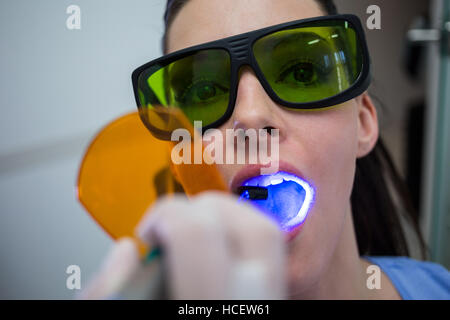 Dentist examining patients teeth with dental curing light Stock Photo
