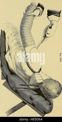 The surgeon's handbook on the treatment of wounded in war - a prize essay (1884)