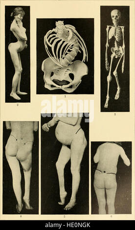 An American text-book of obstetrics. For practitioners and students (1897) Stock Photo