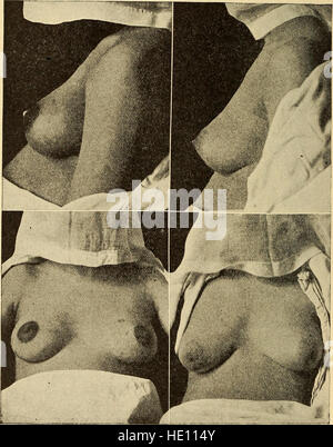 A nurse's handbook of obstetrics, for use in training-schools (1909) Stock Photo