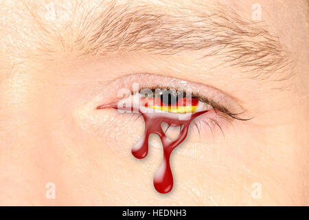 Germany Crying eye Stock Photo