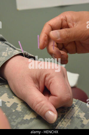 A service member receives acupuncture treatment from Dr. Jae Park, doctor of acupuncture and Oriental medicine, for chronic back pain March 7 at Dwight D. Eisenhower Army Medical Center's Physical Medicine and Rehabilitation Integrative Pain Management Center. (Photo by Bill Bengtson / Fort Gordon Public Affairs Office) Waiting on pins and needles 140307-A-MH852-485 Stock Photo