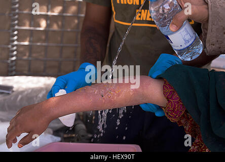 GARMSIR DISTRICT, Helmand province, Islamic Republic of Afghanistan — Navy Petty Officer 3rd Class Steven Dorman sanitizes a burn on the arm of a local child here, May 15. The native of Miami Gardens, Fla., is the senior line corpsman for Bravo Company, 1st Battalion, 3rd Marine Regiment. In addition to treating locals and 1/3 Marines, he maintains accountability of all the corpsman in the company.Dorman said the local community has limited medical resources and expertise.  “They don’t know how to treat certain injuries,” said Dorman, “so I am happy to show them. We’re here not to fight, but t Stock Photo