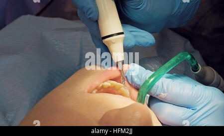 Woman ultrasonic tooth plaque odontolith removing Stock Photo