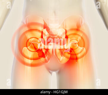 3D illustration, hip painful skeleton x-ray, medical concept. Stock Photo