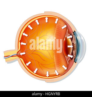 INTRAOCULAR TENSION, ILLUSTRATION Stock Photo