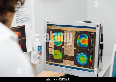 Corneal topography eye vision test for visual description of the shape ...