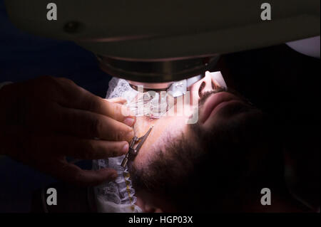 EYE LASER SURGERY Stock Photo