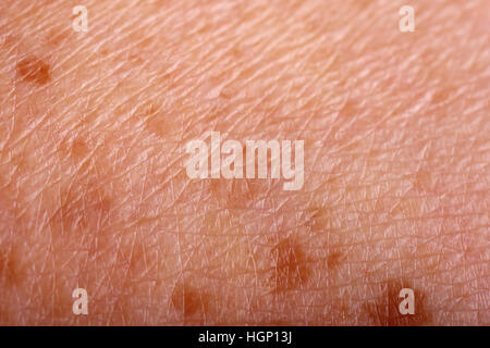 Macro of age spots on old skin with wrinkles. Stock Photo