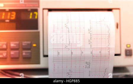 Électrocardiographe ecg moniteur de fréquence cardiaque grossesse maternité  bébé enfant à naître l'impression de lire la vie de signal concept editori  Photo Stock - Alamy