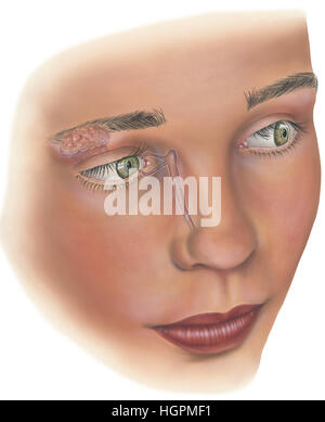 The lacrimal gland Stock Photo - Alamy