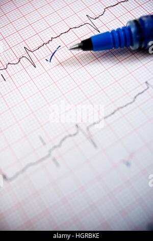 Close up of an electrocardiogram in paper form. Stock Photo
