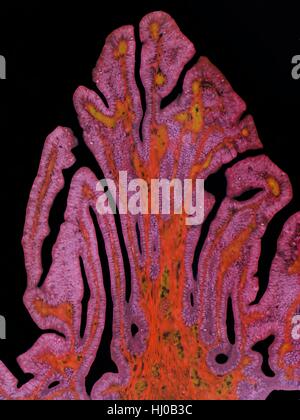 Fallopian tube. Light micrograph (LM) of a section through a fallopian ...
