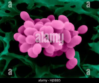 Coloured scanning electron micrograph (SEM) of Enterococcus faecalis (formerly known as Streptococcus faecalis),Gram positive,coccus prokaryote (dividing); causes skin wound infections such as scalded skin syndrome,scarlet fever,erysipelas impetigo.Group Streptococci.Enterococcus faecalis (formerly Stock Photo