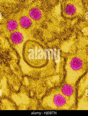 Coloured transmission electron micrograph (TEM) of Zika virus particles (pink) isolated in kidney epithelial cells (Vero E6 cells).Zika viruses have dense core surrounded by envelope (40nm size).Zika virus is RNA (ribonucleic acid) virus in family Flaviviridae causes Zika fever,or Zika Stock Photo