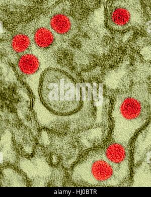 Coloured transmission electron micrograph (TEM) of Zika virus particles (red) isolated in kidney epithelial cells (Vero E6 cells).Zika viruses have dense core surrounded by envelope (40nm size).Zika virus is RNA (ribonucleic acid) virus in family Flaviviridae causes Zika fever,or Zika disease.Aedes Stock Photo