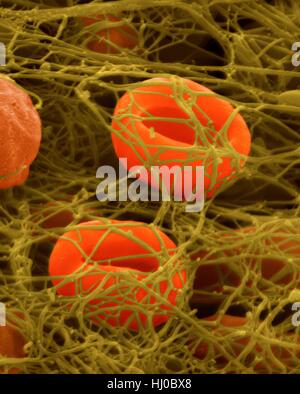 Human red blood cells trapped in fibrin blood clot,coloured scanning electron micrograph (SEM).Human red blood cells trapped in fibrin blood clot.Platelets (not seen) are cell fragments in blood that play essential role in blood clotting wound repair,and can also activate certain immune Stock Photo